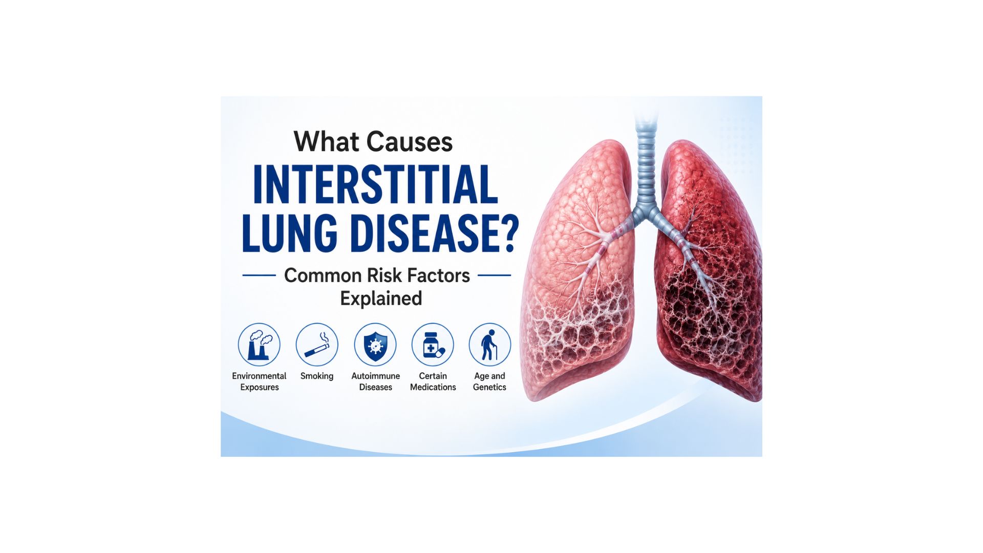 What Causes Interstitial Lung Disease? Common Risk Factors Explained
